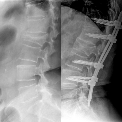 Blank 2 Grids Collage (3)